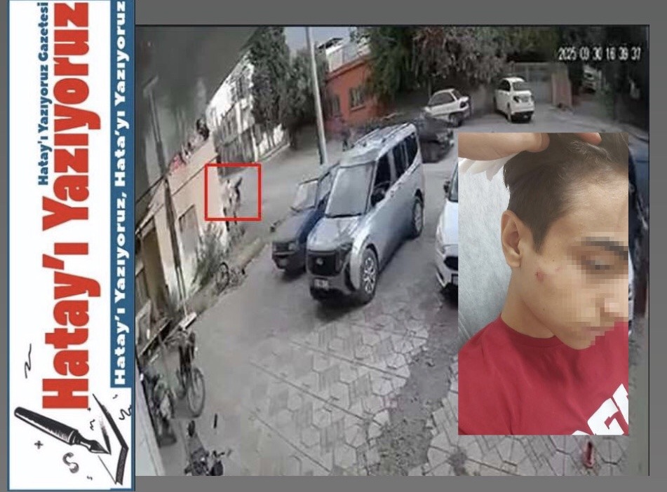 DEMİR SOPALI SALDIRIYA UĞRAYAN ÖĞRENCİ YARALANDI